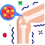 bone-cancer